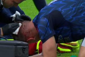 加布里埃尔争顶时把约克雷斯头撞出血，后者缠绷带后继续比赛